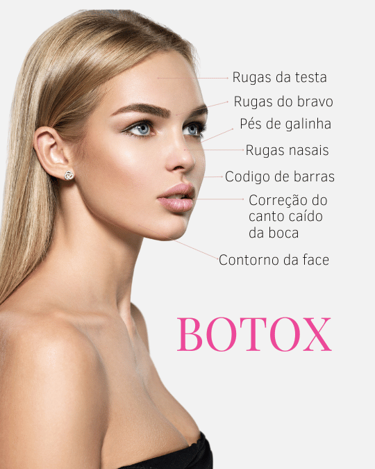 Resultado de preenchimento labial natural